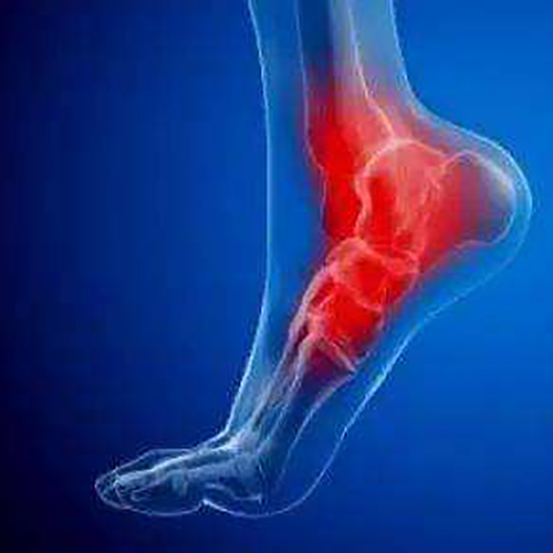 足底筋膜炎に最適な3本つま先のスチールトゥワークブーツ